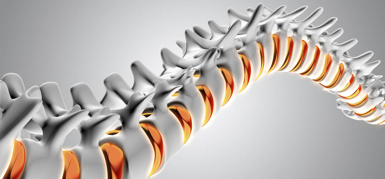 Arthritis of the Spine