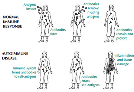 Immunological Diseases