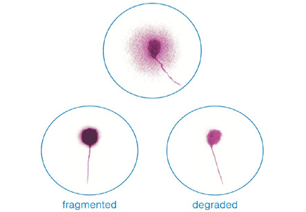 Sperm DNA Fragmentation